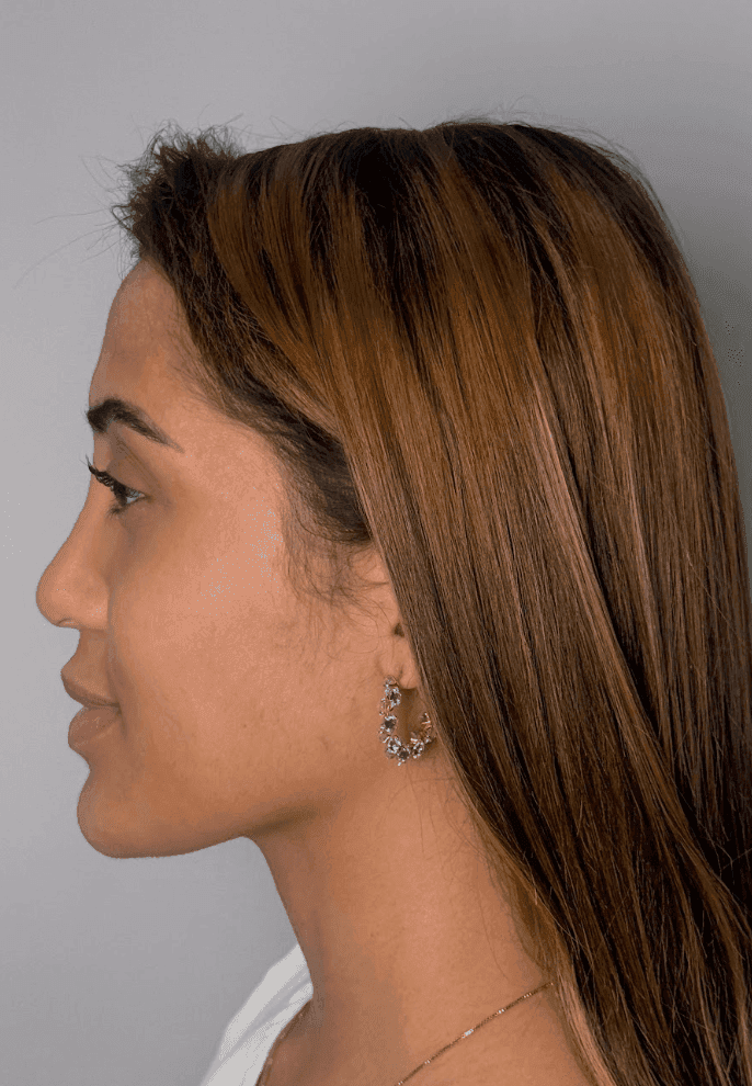Top Model Look — antes e depois